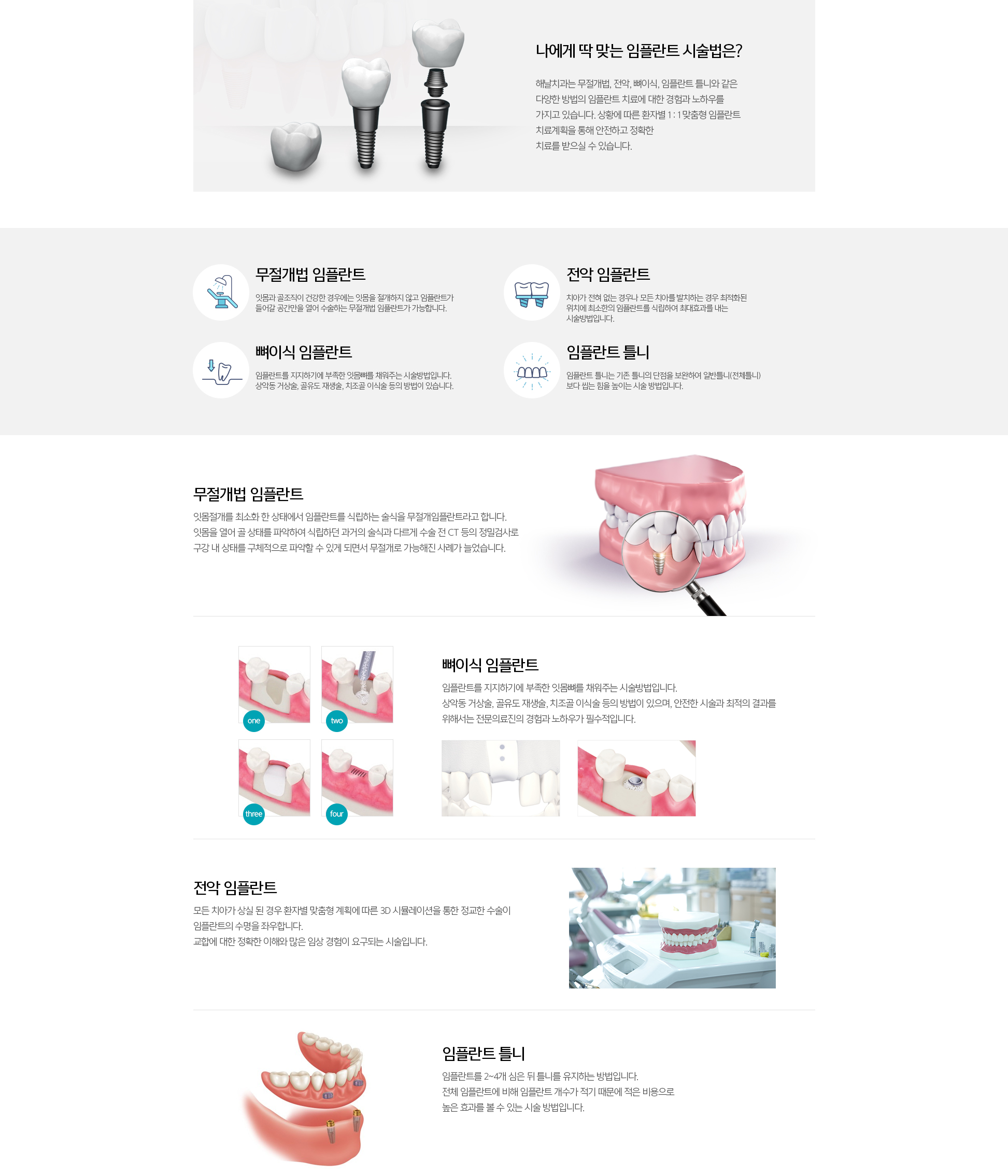 임플란트클리닉